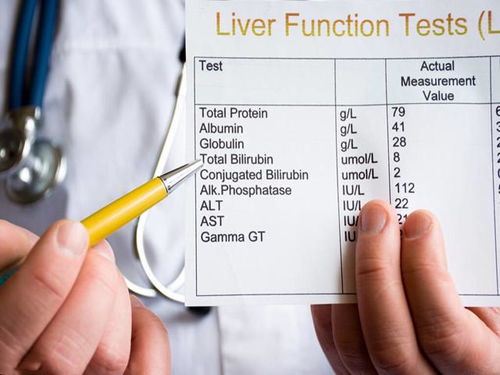 快速降转氨酶最好的药:快速降转氨酶最好的药?专家,先查病因再用药!