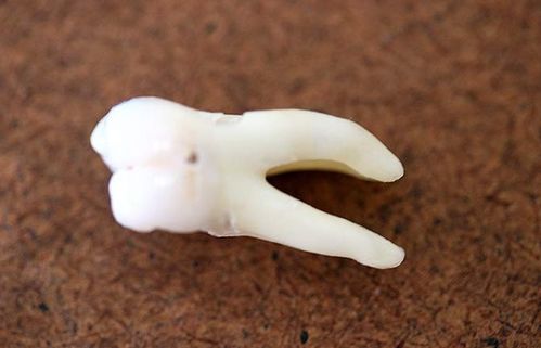 梦见牙掉了是什么意思:梦见牙掉了,心理学与传统文化中的双重解读 梦见牙掉了是什么意思:梦见牙掉了,心理学与传统文化中的双重解读