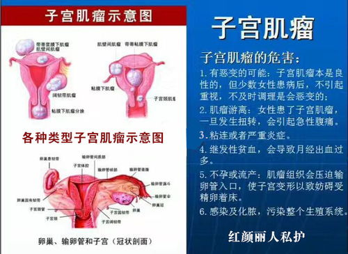 中医治疗肿瘤哪里好:中医治疗肿瘤哪里好?名院推荐与治疗优势解析 中医治疗肿瘤哪里好:中医治疗肿瘤哪里好?名院推荐与治疗优势解析
