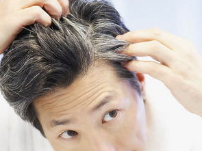 梦见自己长白头发拔掉:梦里长白头发拔掉,我看到了什么?