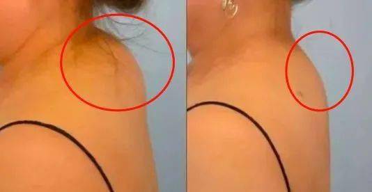 一只眼睛疼另一只正常:单眼不适怎么办?探究一只眼睛疼另一只正常的原因与应对方法