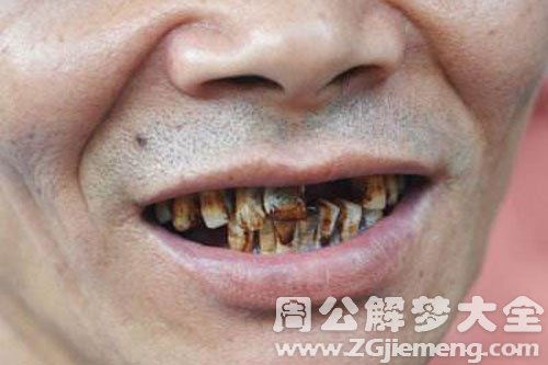 梦见牙齿脱落是黑色的:黑色脱落的牙齿,梦境背后的隐喻与警示