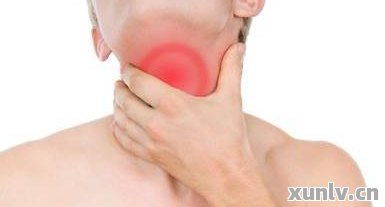 喉咙老有黏痰:喉咙老有黏痰?这些原因和解决方法你一定要知道! 喉咙老有黏痰:喉咙老有黏痰?这些原因和解决方法你一定要知道!