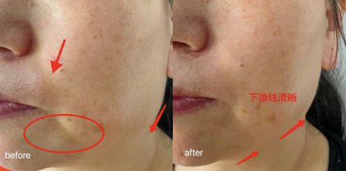 头上有花斑癣怎样治疗:头上有花斑癣怎样治疗?这些方法有效又实用 头上有花斑癣怎样治疗:头上有花斑癣怎样治疗?这些方法有效又实用