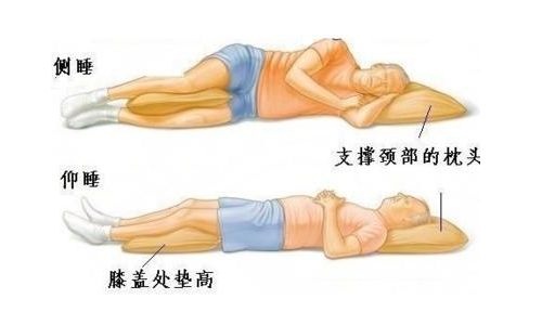 椎间盘突出正确睡姿图:椎间盘突出患者的福音,掌握正确睡姿,缓解腰部不适(含椎间盘突出正确睡姿图)