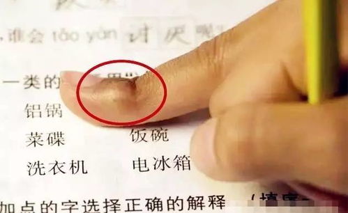 5秒止牙痛的偏方:神奇!5秒止牙痛偏方,亲测有效