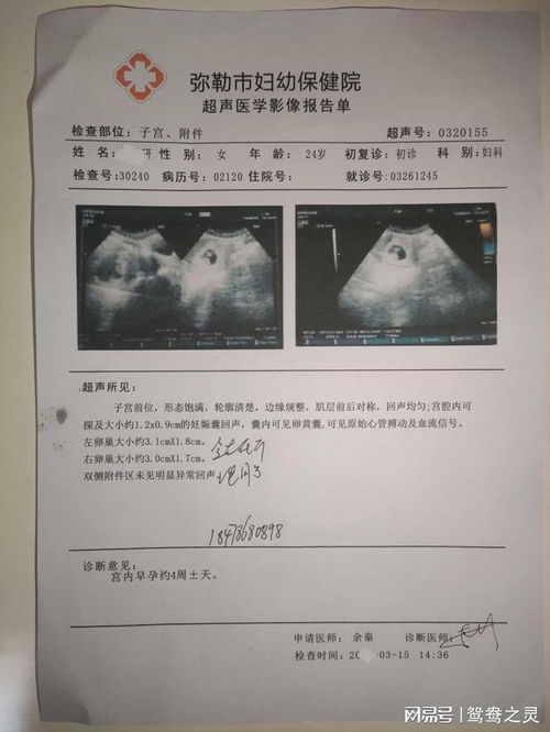 40天打胎下来的图片:40天打胎后的身体恢复与心理调适 40天打胎下来的图片:40天打胎后的身体恢复与心理调适