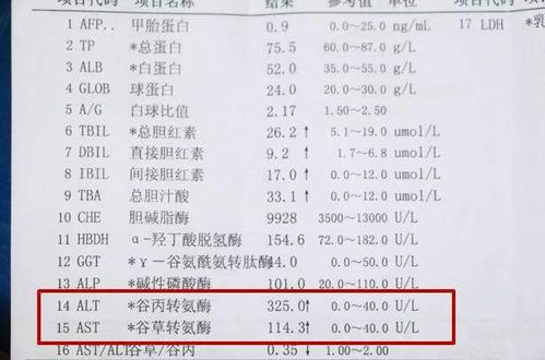 谷丙转氨酶80严重吗:谷丙转氨酶80,解读你的肝脏健康密码 谷丙转氨酶80严重吗:谷丙转氨酶80,解读你的肝脏健康密码
