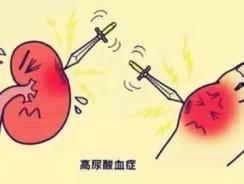 红细胞偏高一点要紧吗:红细胞偏高一点,这些原因你必须知道! 红细胞偏高一点要紧吗:红细胞偏高一点,这些原因你必须知道!