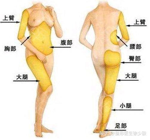 180斤抽脂可以瘦多少斤:180斤抽脂到底能瘦多少?真相在这里! 180斤抽脂可以瘦多少斤:180斤抽脂到底能瘦多少?真相在这里!