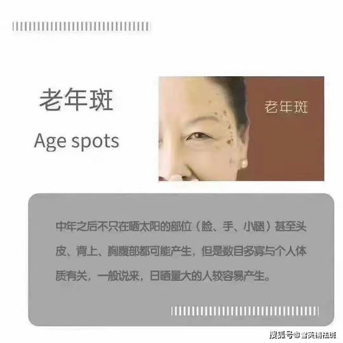 怎样可以淡斑祛斑小妙招:告别暗沉,重焕肌肤光彩—日常生活中简单有效的淡斑祛斑小妙招 怎样可以淡斑祛斑小妙招:告别暗沉,重焕肌肤光彩—日常生活中简单有效的淡斑祛斑小妙招