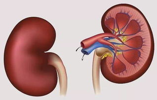 肾结石:肾结石,身体里的隐形炸弹,如何预防与应对? 肾结石:肾结石,身体里的隐形炸弹,如何预防与应对?