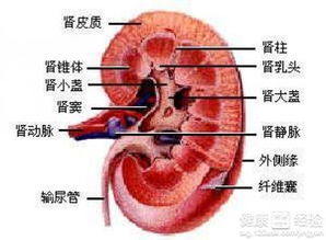 肾结石:肾结石,身体里的隐形炸弹,如何预防与应对? 肾结石:肾结石,身体里的隐形炸弹,如何预防与应对?