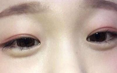 双鱼座是单眼皮还是双眼皮:双鱼座是单眼皮还是双眼皮?星座与外貌的神秘关联揭秘 双鱼座是单眼皮还是双眼皮:双鱼座是单眼皮还是双眼皮?星座与外貌的神秘关联揭秘