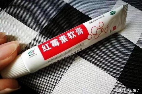 红霉素治好了我的痔疮:红霉素软膏,我的痔疮意外救星?亲身经历告诉你这可能有效!