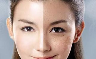 去脸上的斑要多少钱:去脸上的斑要多少钱?价格参考与选择指南 去脸上的斑要多少钱:去脸上的斑要多少钱?价格参考与选择指南