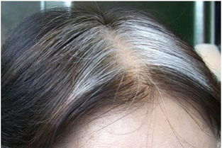 梦见长白头发周公解梦原版:梦见长白头发,周公解梦原版解析与现代启示 梦见长白头发周公解梦原版:梦见长白头发,周公解梦原版解析与现代启示