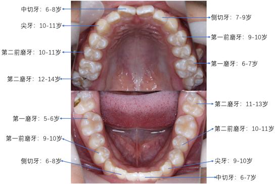 门牙掉了最快的遮丑办法:门牙掉了最快的遮丑办法,这些方法你一定要知道! 门牙掉了最快的遮丑办法:门牙掉了最快的遮丑办法,这些方法你一定要知道!