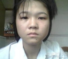 脸肿是什么原因引起的:脸肿是什么原因引起的?这些常见原因你需要知道 脸肿是什么原因引起的:脸肿是什么原因引起的?这些常见原因你需要知道