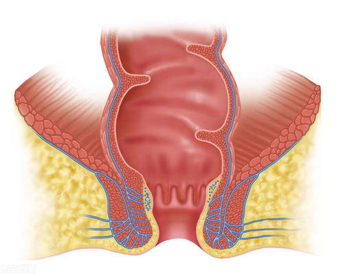 怎么判断自己是不是痔疮:这些症状可能是痔在提醒你!怎么初步判断自己是不是得了痔疮? 怎么判断自己是不是痔疮:这些症状可能是痔在提醒你!怎么初步判断自己是不是得了痔疮?