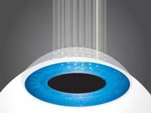 激光矫正视力:告别眼镜,重获清晰视界,激光矫正视力的原理、适应症与安全性