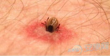 梦见虫子钻进身体里:梦里虫子钻进身体,这些隐喻你懂吗? 梦见虫子钻进身体里:梦里虫子钻进身体,这些隐喻你懂吗?