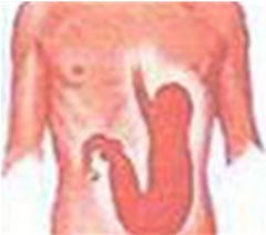 快速去火的小偏方:上火了别急!这些快速去火偏方超管用 快速去火的小偏方:上火了别急!这些快速去火偏方超管用