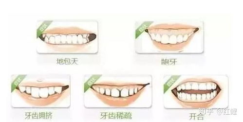 整牙要多少钱：整牙要多少钱？全面解析影响价格的关键因素