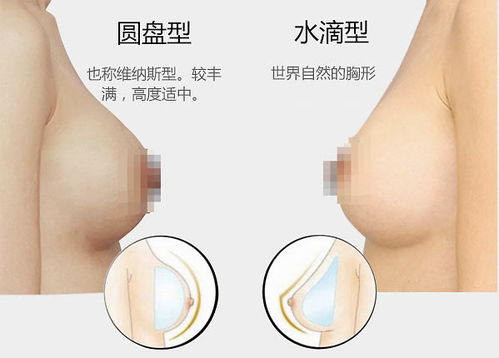 假体隆胸取出可以马上填充脂肪吗：假体隆胸取出后可以马上填充脂肪吗？