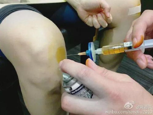 多囊治疗三个月消失了:三个月奇迹!我的多囊治疗经历,症状竟然消失了 多囊治疗三个月消失了:三个月奇迹!我的多囊治疗经历,症状竟然消失了