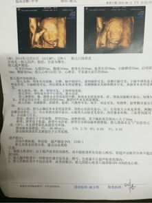 四维一看就是男孩:四维彩超看男女,传说背后的真实科学