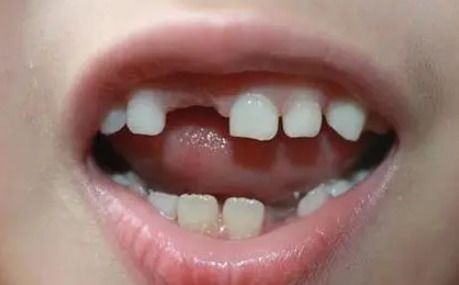 已婚女人梦到牙齿脱落了一大把:梦里牙齿全掉了,已婚女性的焦虑与自我救赎