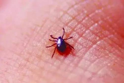 千万别把丝状疣想象的太严重:千万别把丝状疣想象的太严重,认识这种常见皮肤问题,科学应对不焦虑 千万别把丝状疣想象的太严重:千万别把丝状疣想象的太严重,认识这种常见皮肤问题,科学应对不焦虑