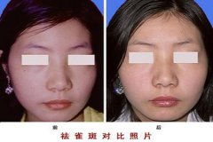 整容医院哪里最好要多少钱:整容医院哪里最好?费用到底要多少?全面解析与实用指南 整容医院哪里最好要多少钱:整容医院哪里最好?费用到底要多少?全面解析与实用指南