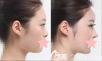 整容医院哪里最好要多少钱:整容医院哪里最好?费用到底要多少?全面解析与实用指南 整容医院哪里最好要多少钱:整容医院哪里最好?费用到底要多少?全面解析与实用指南