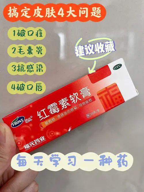红霉素软膏能治痘痘吗：红霉素软膏治疗痘痘，有效但需谨慎使用