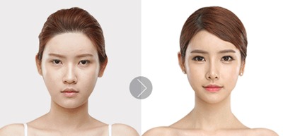 打一针玻尿酸 多少钱:打一针玻尿酸到底多少钱?看完这篇你就懂了!