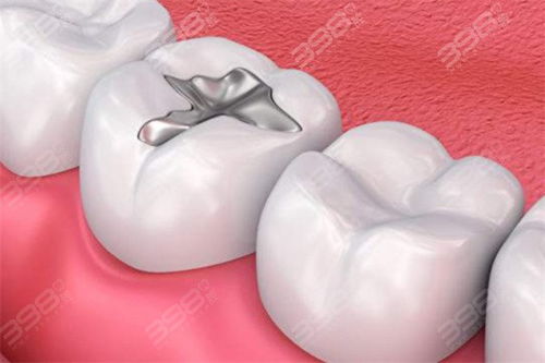 假牙一颗牙大概多少钱:假牙一颗牙大概多少钱?详细解析费用构成与选择建议 假牙一颗牙大概多少钱:假牙一颗牙大概多少钱?详细解析费用构成与选择建议