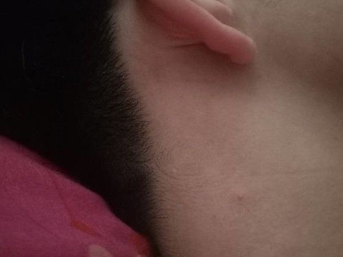 隐私左侧长了个疙瘩是怎么治：隐私左侧长了个疙瘩是怎么治？这些原因和应对方法要知道！