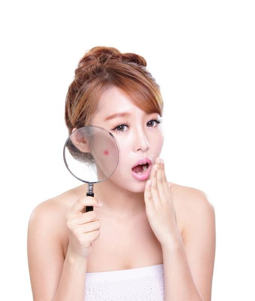 长痘怎么快速消除：长痘了别慌！这5招教你快速消除痘痘，告别满脸油光！