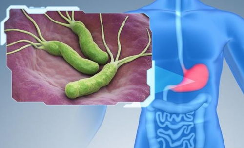 肺部感染最怕三个征兆：肺部感染最怕三个征兆，出现一个就要警惕！