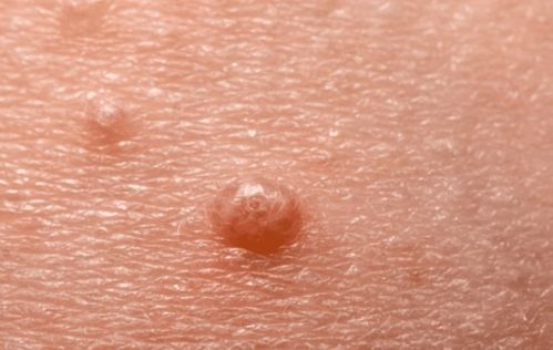 正常夫妻咋就感染hpv阳性：正常夫妻咋就感染HPV阳性？这些原因你一定要知道！