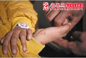 梦见自己被狗咬了是什么征兆：梦见自己被狗咬了是什么征兆？