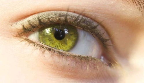 角膜炎有哪些症状：警惕角膜炎！这些症状不可忽视，早发现早治疗是关键