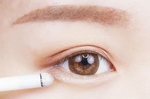 凸眼球矫正手术：告别凸眼困扰，重获清晰视界与自信外观—探秘凸眼球矫正手术