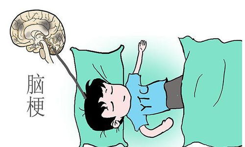 一过性头晕是脑梗前期吗:一过性头晕是脑梗前期吗?专家解读与应对指南