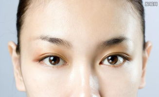 眼皮抽脂手术大概花多少钱:眼皮抽脂手术价格解析,影响因素与费用参考