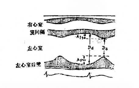 射完一次后多久恢复硬度正常：射精后多久恢复硬度？了解男性生理恢复时间与促进方法