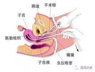 射完一次后多久恢复硬度正常：射精后多久恢复硬度？了解男性生理恢复时间与促进方法