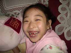 梦见自己上牙掉了好多颗:梦见自己上牙掉了好多颗,解析梦境背后的隐喻与心理暗示 梦见自己上牙掉了好多颗:梦见自己上牙掉了好多颗,解析梦境背后的隐喻与心理暗示